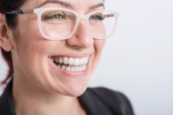 Aligner - fast unsichtbar im Berufsalltag