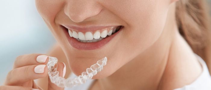 Aligner für Erwachsene in Hildesheim